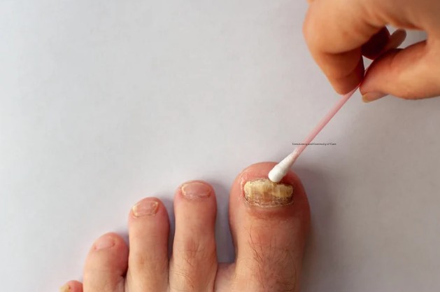 Preventing Future Infections