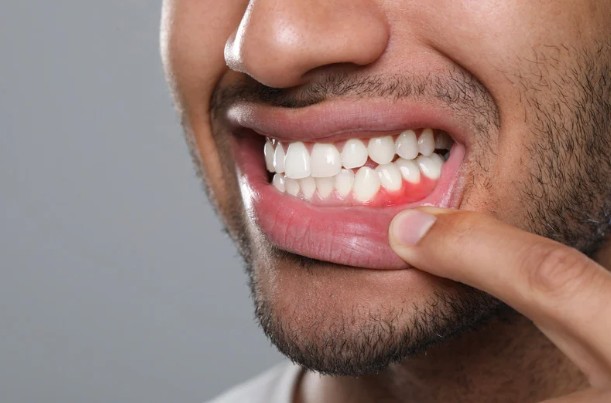 How Gum Disease Affects the Body