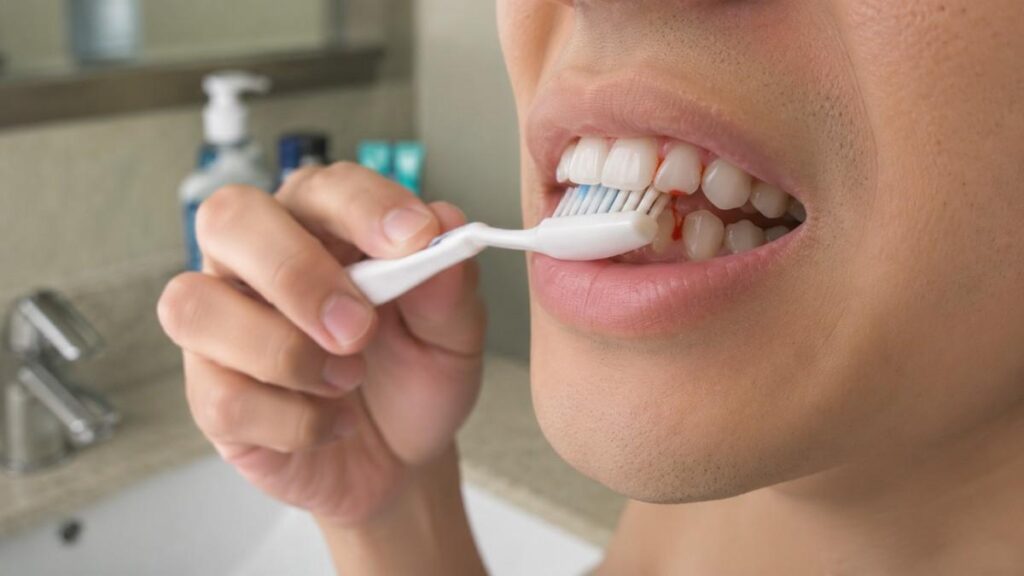 Bleeding During Routine Care